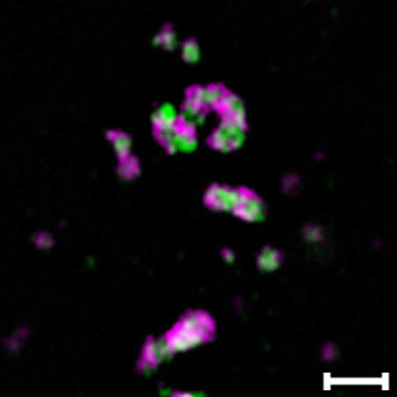 超解像度顕微鏡で観察した黄体細胞のパラスペックル (SIM)