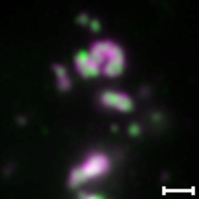 超解像度顕微鏡で観察した黄体細胞のパラスペックル (Widefield)