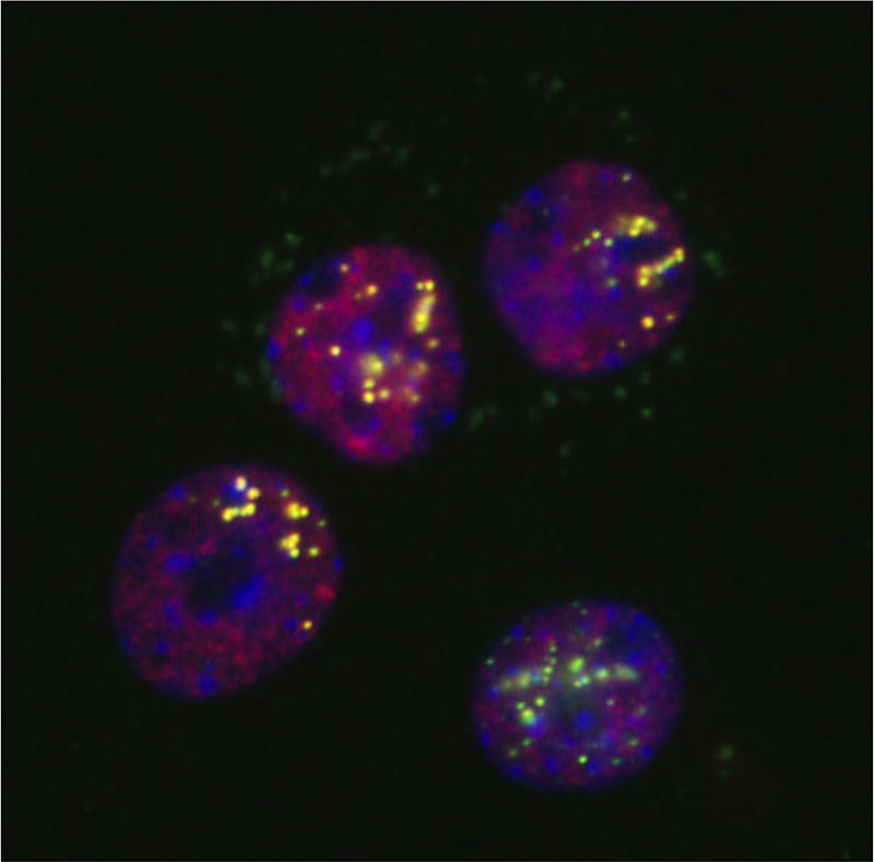 蛍光顕微鏡で観察した黄体細胞のパラスペックル